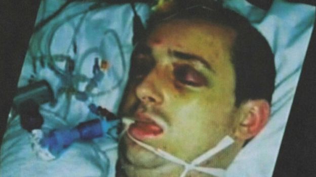 Paul Pugh en el hospital tras haber sido brutalmente golpeado en la calle en 2007.