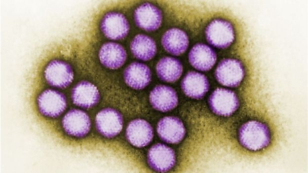 Colourised TEM (transmission electron microscopic) image of adenovirus