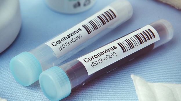 கொரோனா வைரஸ்: 12 பில்லியன் டாலர், 54 ஆயிரம் இரான் கைதிகள் - 10 தகவல்கள்