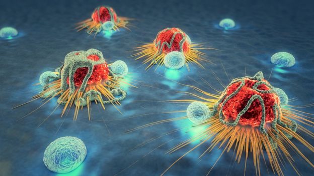 Células cancerosas siendo atacadas por linfocitos.