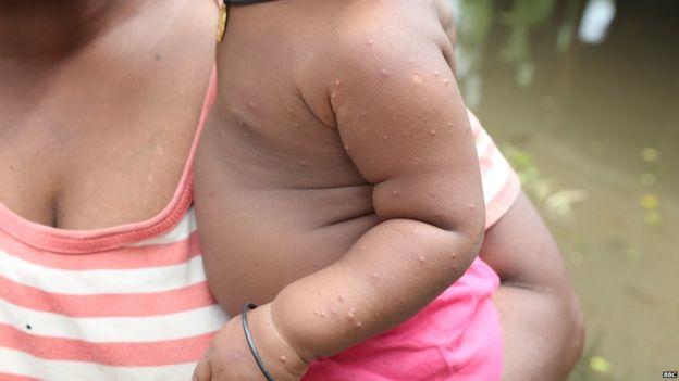 "සෞඛ්ය ගැටලු ගැන විමසිලිමත් වන්න"