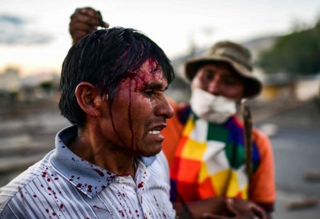 Homem ferido em protesto na Bolívia