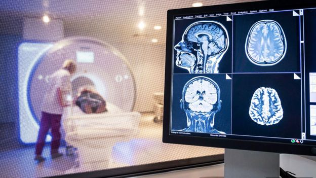 El personal de radiología realiza una resonancia magnética de un cerebro.