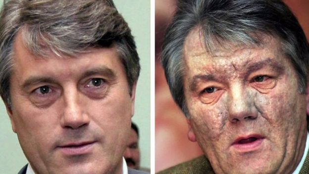 Ukraines former president Viktor Yushchenko