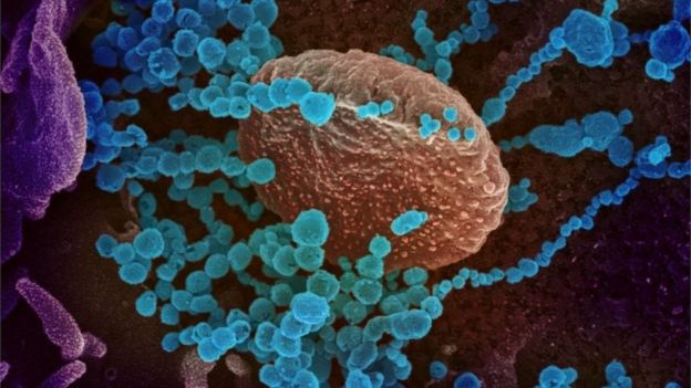 Imagem de microscópio do novo coronavírus