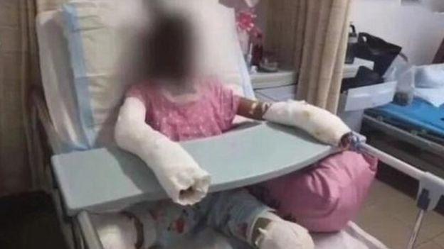 This picture, allegedly showing the 12-year-old victim, has been widely circulated on Weibo