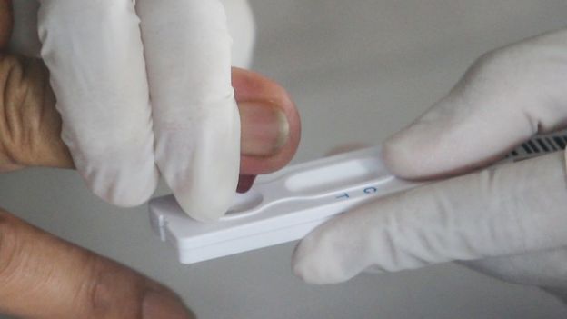 Toma de una gota de sangre para aplicar la prueba serológica de covid-19.