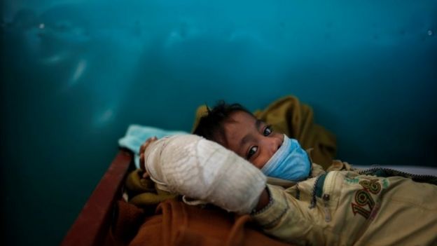 Rohingya refugee Yasin Arfat, 6, who suffers from diphtheria, lays on a bed