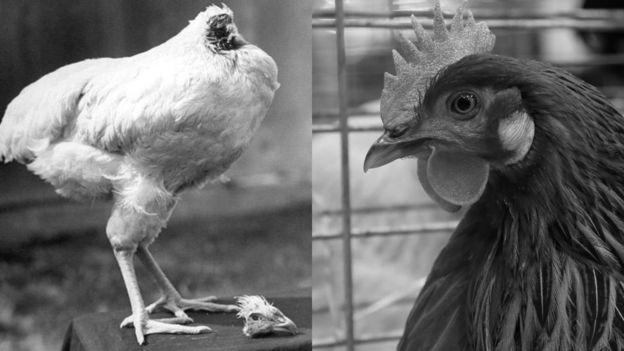 'மிராகிள் மைக்'