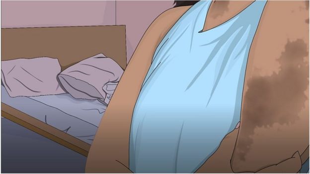 Dessin représentant une femme victime d'agression sexuelle