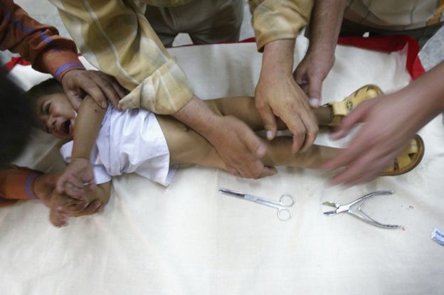 Asian baby boy circumcision photo 470