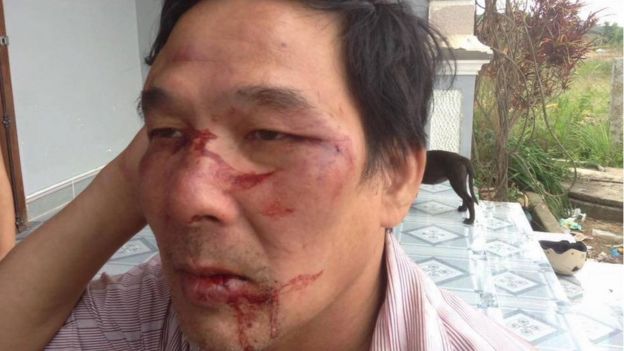Image result for Cựu chiến binh chống TQ, ông Lê Đình Lượng bị bắt