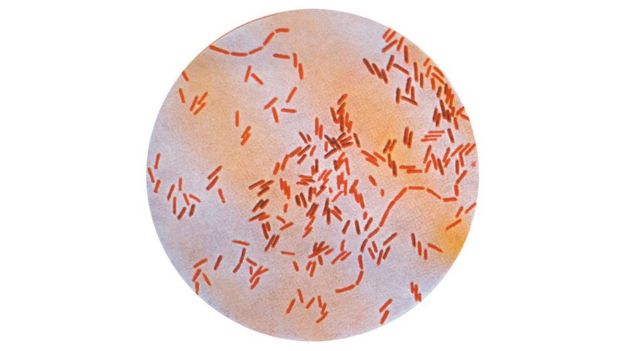 bactérias que provocam a febre tifoide