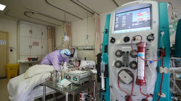 ECMO machine