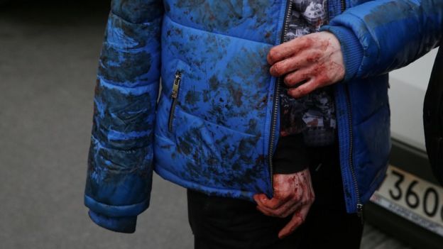 An injured person walks outside Sennaya Ploshchad metro station, following explosions in two train carriages at metro stations in St Petersburg, Russia April 3, 2017