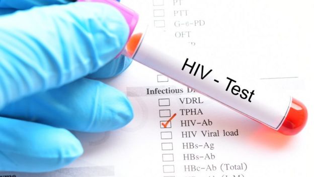 Test de VIH.
