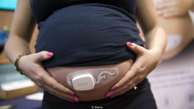Mulher grávida com sensor
