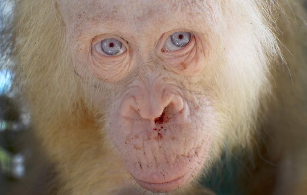 Picture of the Albino orangutan, with blue eyes and white/blond hair, looking straight at the camera, with some dried blood seen in its nose