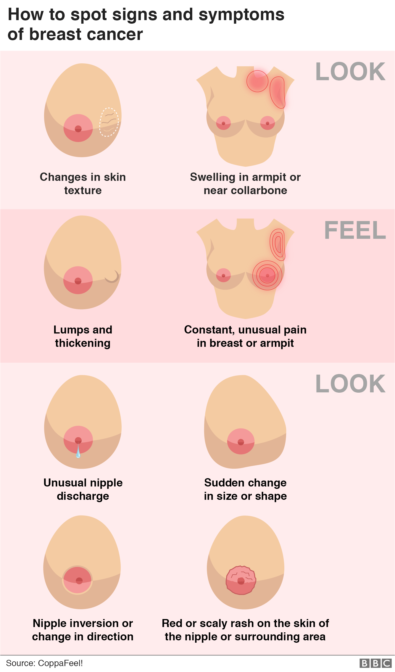 Graphic showing how to spot the signs and symptoms of breast cancer