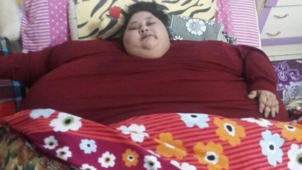 Former 'heaviest Woman' Eman Ahmed Abd El Aty Dies - Bbc News