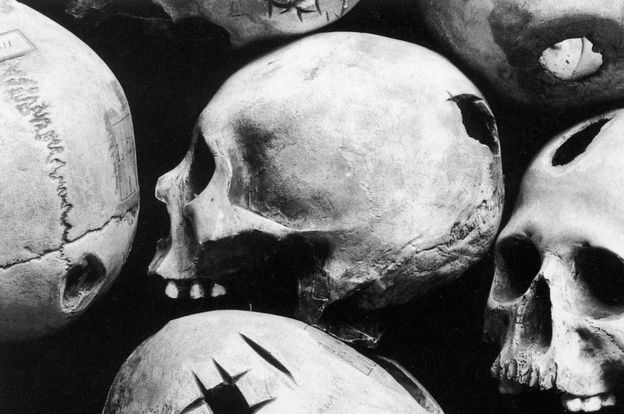 Modelos de crneos peruanos trepanados