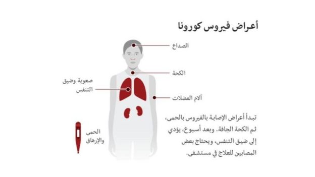 رسم توضيحي لأعراض الإصابة بفيروس كورونا