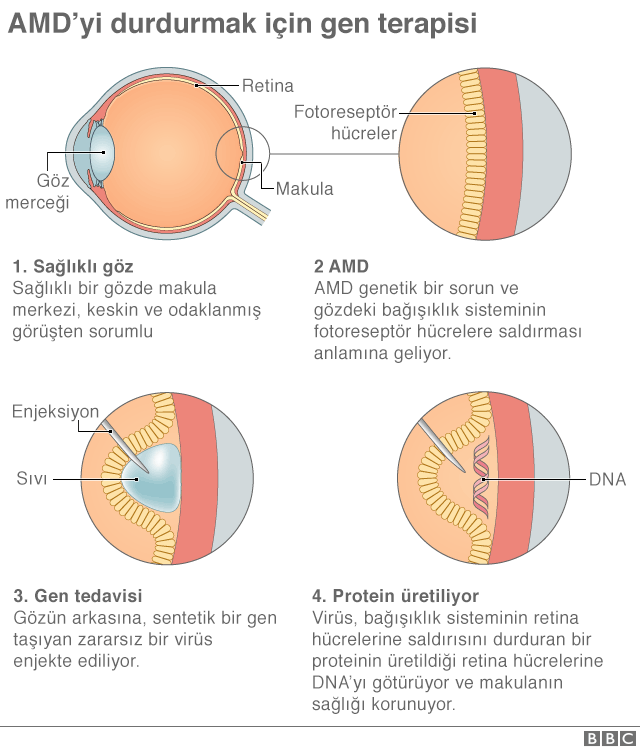 grafik