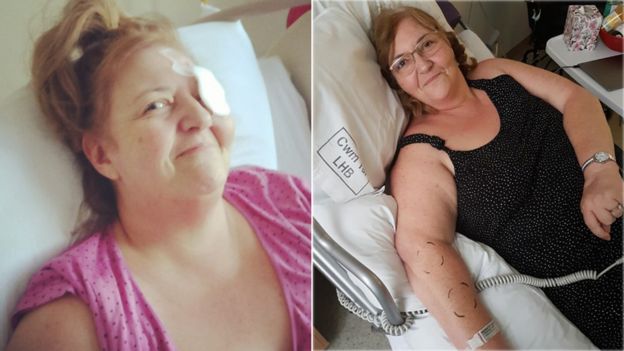 Nikki in the early days in hospital - and in rehabilitation