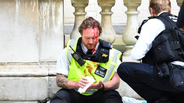 A police officer receives medical attention after police clashed with demonstrators in Whitehall