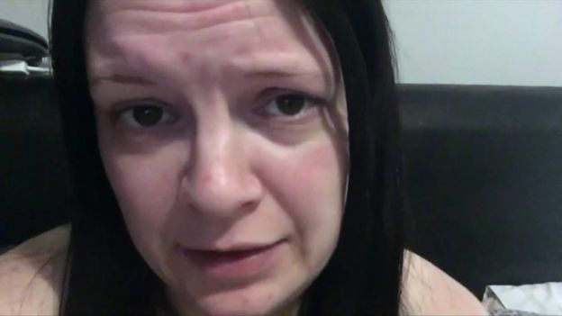 Laura's HG means she struggles to eat or drink