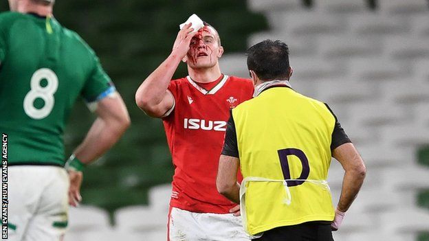 Shane Lewis-Hughes was one of several Wales players to show the effects of a hard night defensively