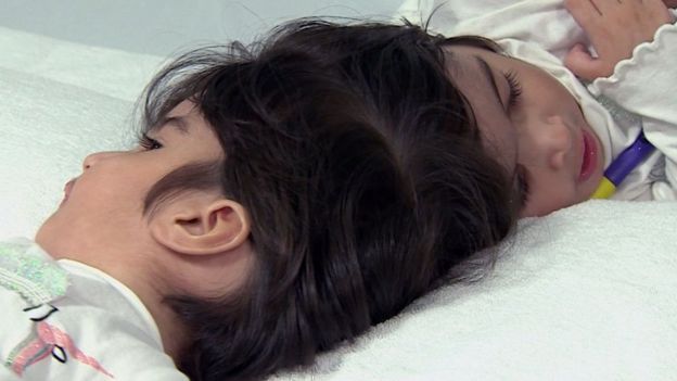 இரட்டையர்கள்