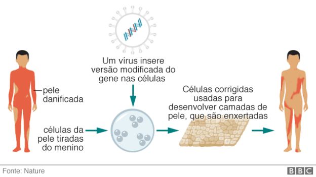Gráfico