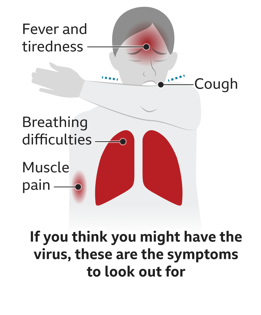 Text reads: If you think you might have the virus, these are the symptoms to look out for