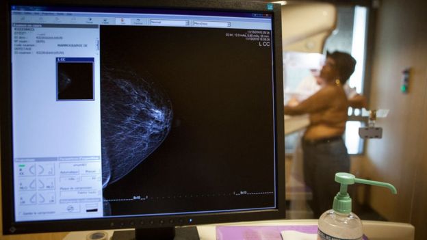 Una mujer durante una mamografía.