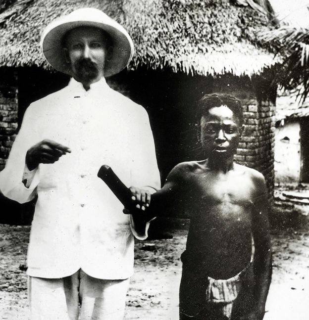 Missionaries documented amputations while investigating abuses committed in Congo Free State