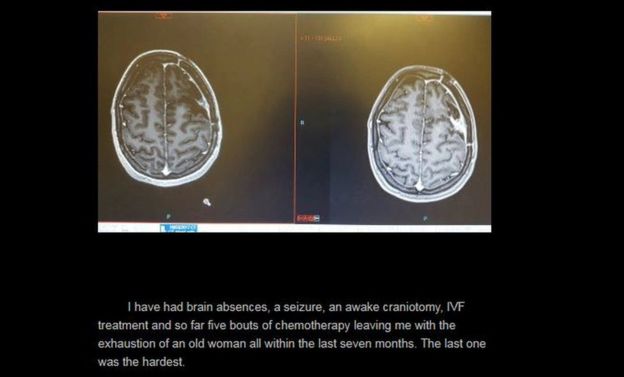 Foto de Sarah-May ha escrito sobre su tratamiento en su blog y ha compartido las imágenes del tumor