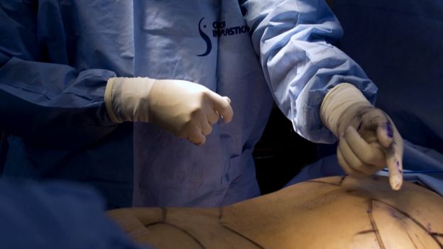 பேரியாட்ரிக் அறுவை சிகிச்சை