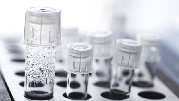 收获人类的蛋。 这些鸡蛋将用于体外受精(IVF)治疗