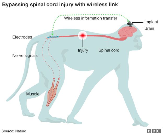 Brain wi-fi' reverses leg paralysis in primate first - BBC News