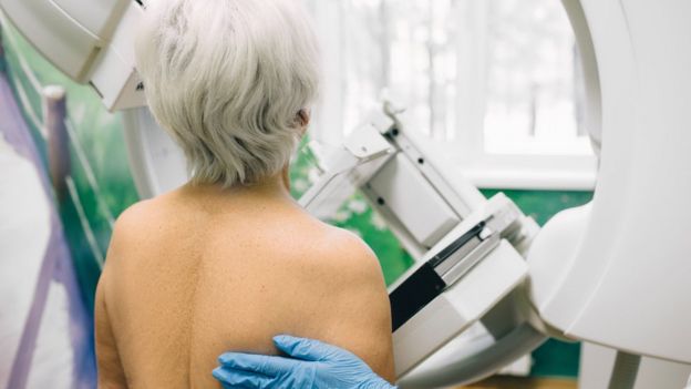 Woman having a mammogram or breast cancer screening