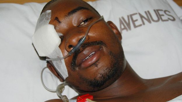 Nelson Chamisa in hospital in Harare, Zimbabwe - 2007