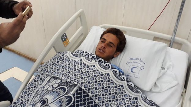 A picture taken with a mobile phone shows an injured man, identified as Reda, who survived Sinai mosque attack, receiving treatment at a hospital in Cairo,