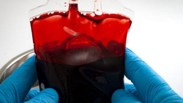 ถุงเลือด