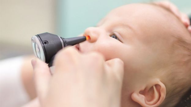 Un médico revisa la nariz de un bebé.