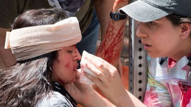 Dos mujeres con sangre tras los enfrentamientos de Charlottesville.