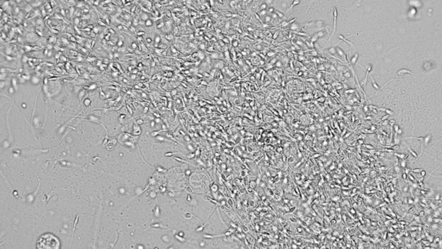 Vista microscópica de esperma en blanco y negro