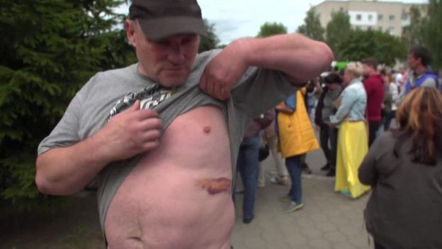 Man shows BBC his bruising outside Okrestina centre