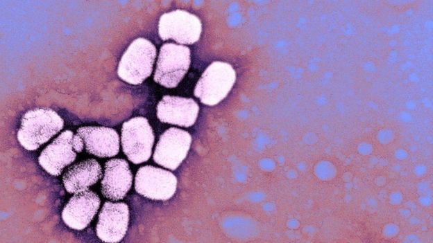La viruela era causada por el virus variola.