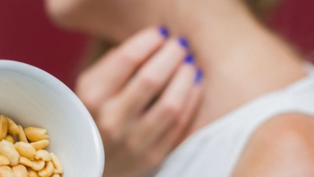 Mulher coçando pescoço e pote de amendoim em primeiro plano